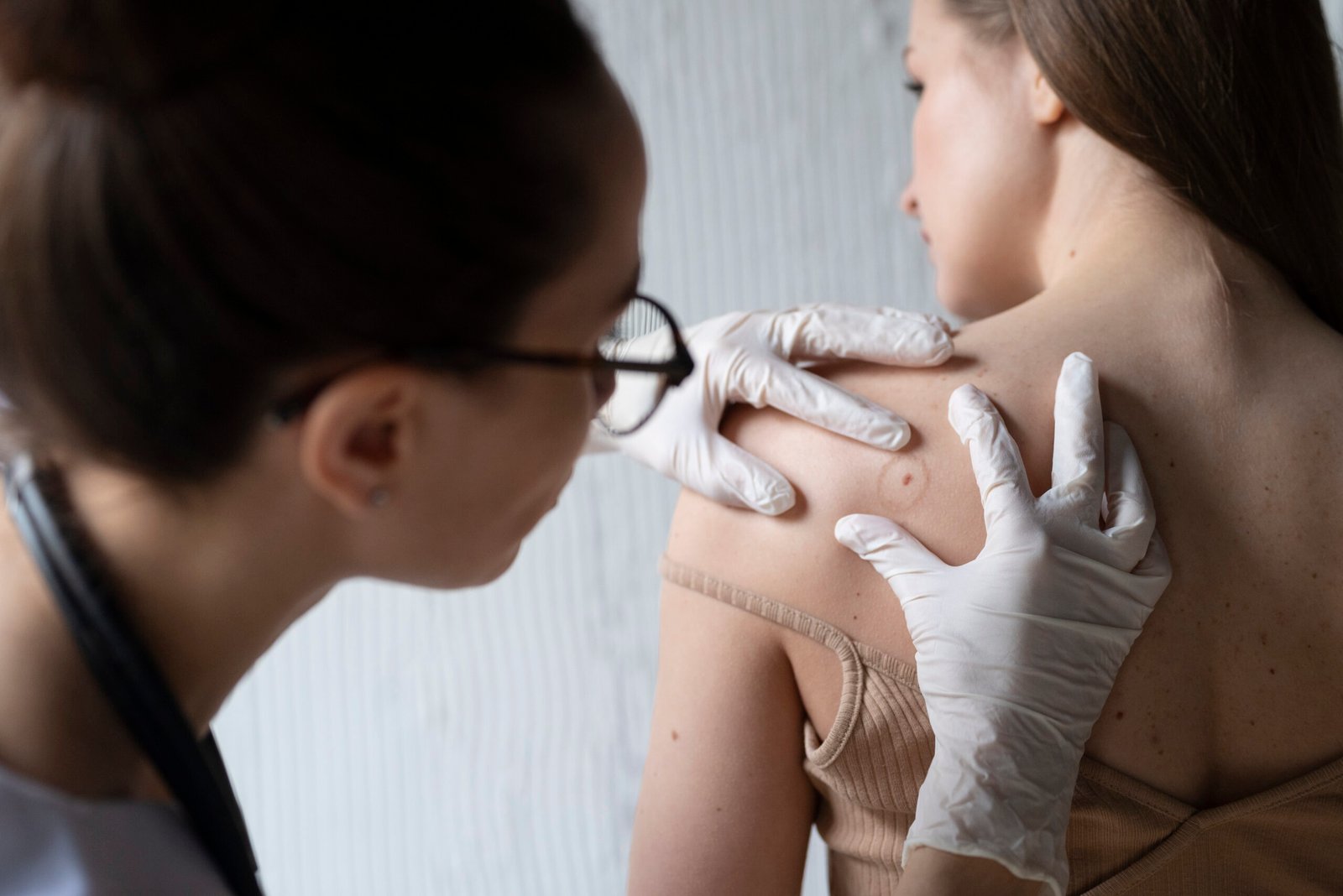 Female doctor examining patient’s skin for signs of melanoma during diagnosis.
