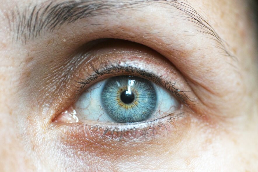 Close-up of a human eye with a vivid blue iris featuring green and yellow hues near the pupil, surrounded by visible red veins in the sclera and detailed skin texture.