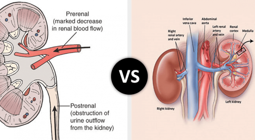 Chronic Renal Failure (CRF): A Comprehensive Guide to Treatment