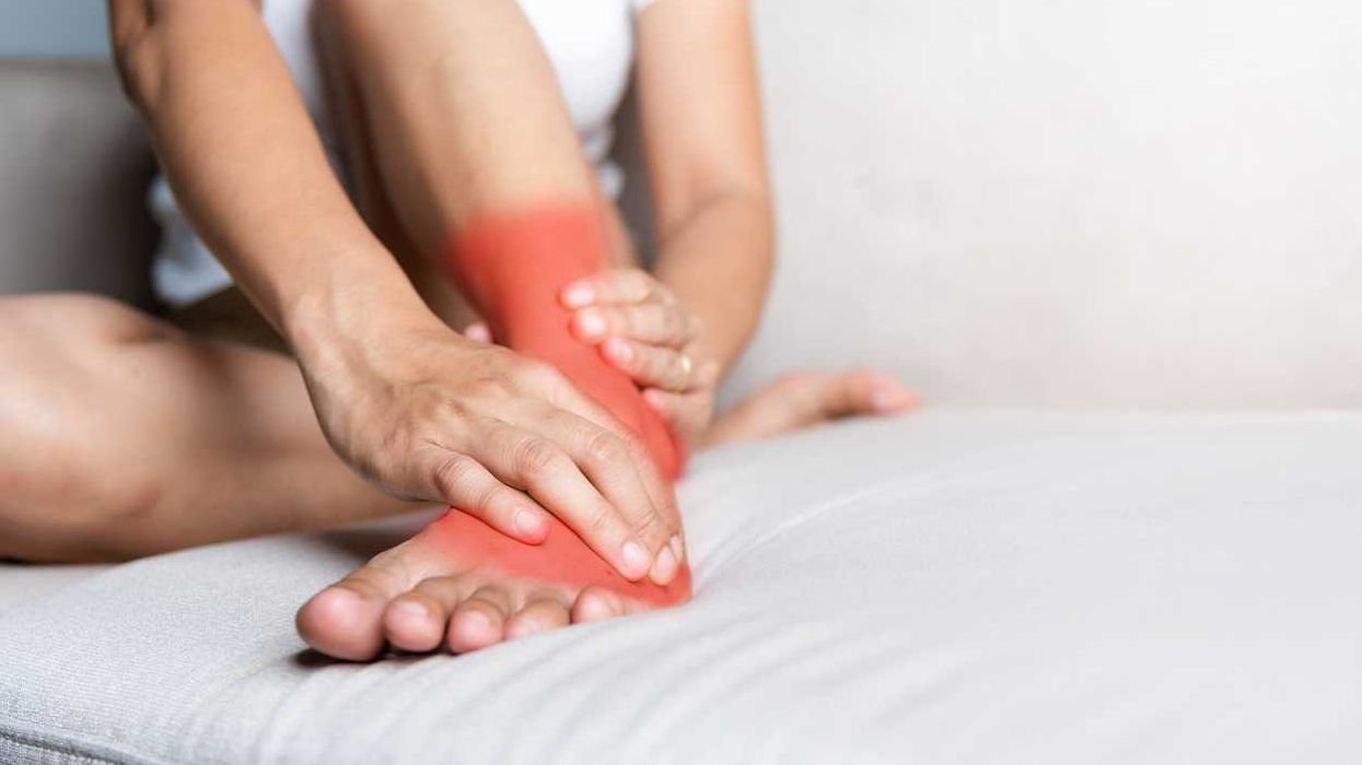 Complex Regional Pain Syndrome (CRPS) 101