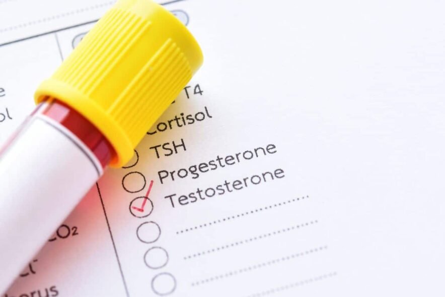 Everything about testosterone you didn’t know (but probably should)