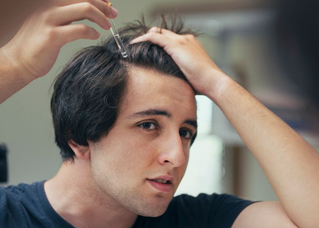 Hair regrowth for men: 10 tips to regrow thinning hair
