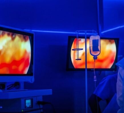 Laparoscopic Gallbladder Removal