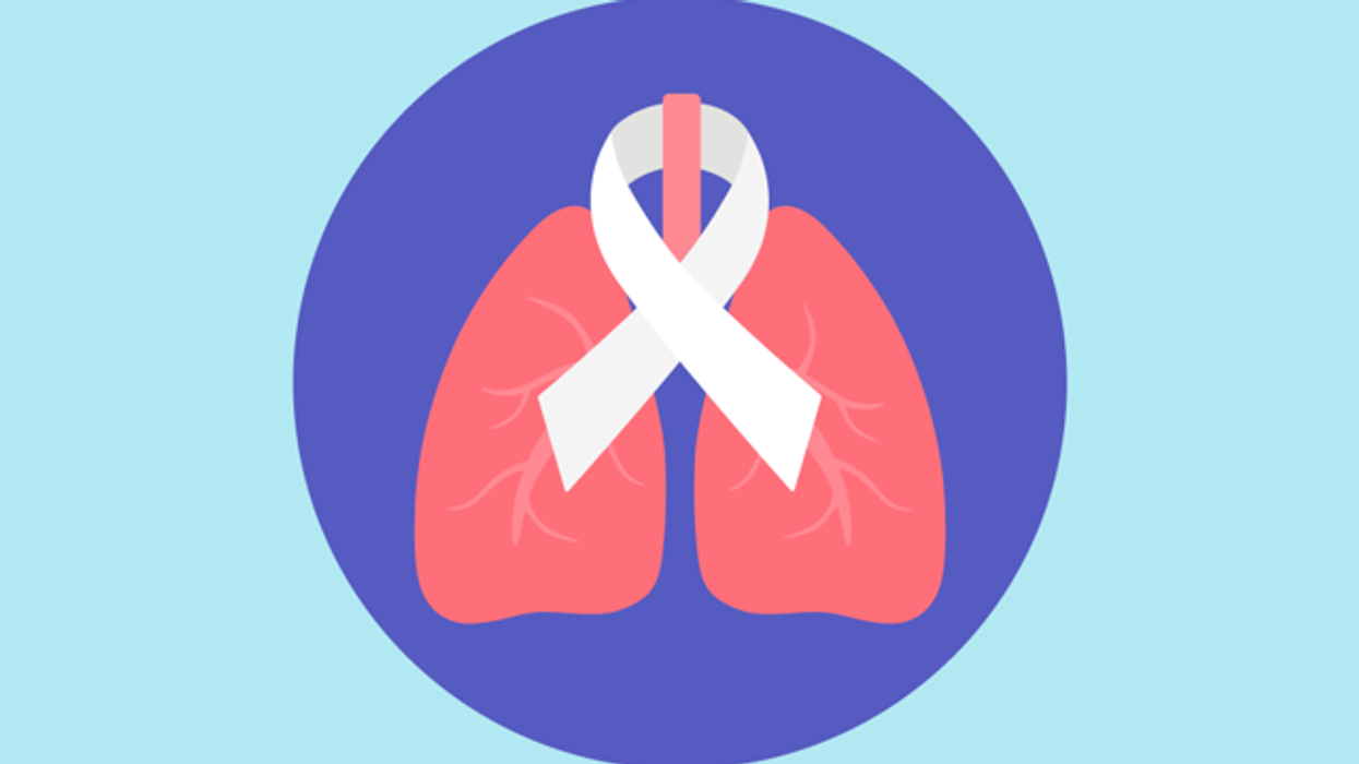 Síntomas de cáncer pulmonar