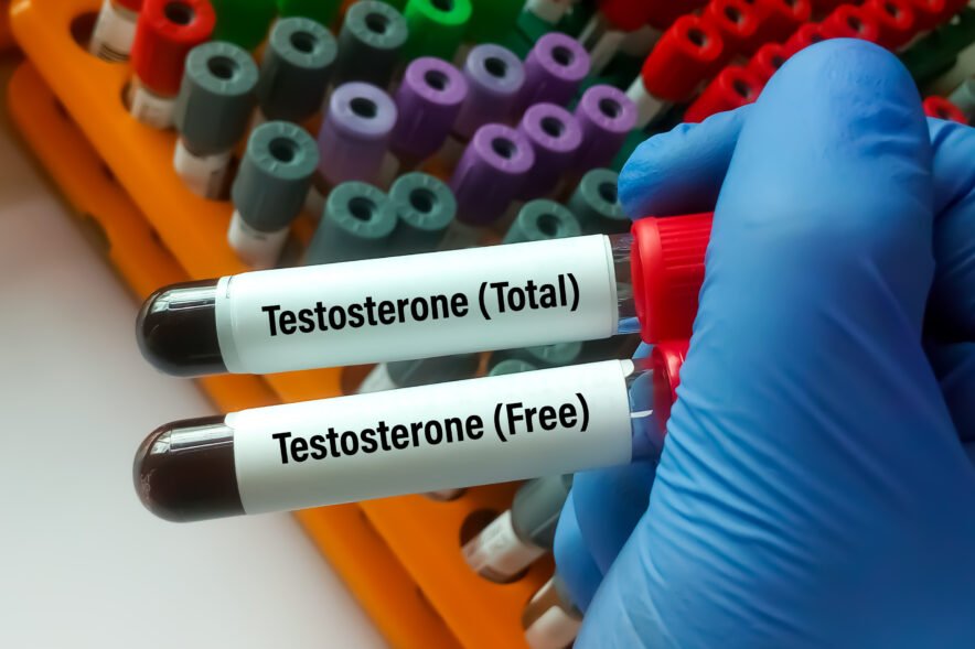 Total vs. free testosterone: What’s the difference & why it matters