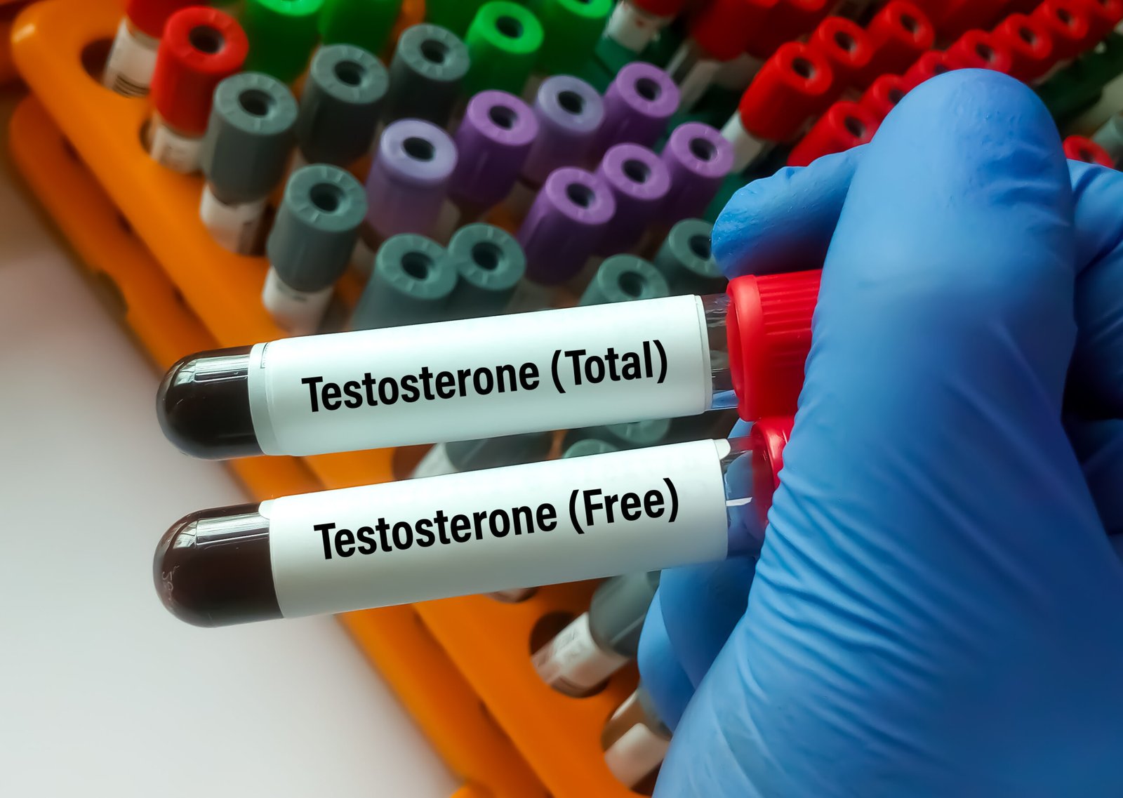 Total vs. free testosterone: What’s the difference & why it matters