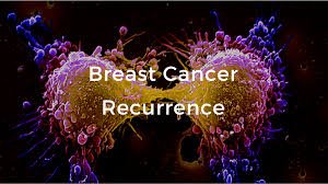 Signs of Breast Cancer Recurrence