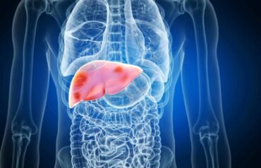 Digital illustration of a semi-transparent human torso highlighting the liver in red and pink tones, with red spots indicating inflammation or disease