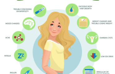 Symptoms, Diagnosis, and Lifestyle Tips for Women With PCOS