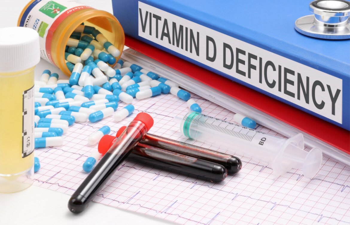 Low Vitamin D? Signs You Shouldn’t Ignore