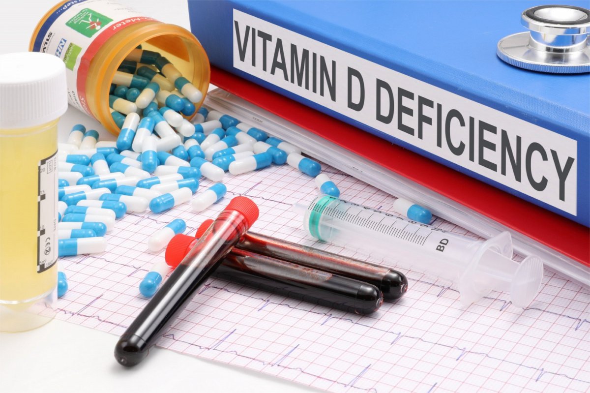 Medical items arranged around a blue binder labeled "Vitamin D Deficiency," including capsules, blood and urine sample containers, a stethoscope, syringe, and ECG printout.